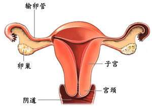 什么是念珠性阴道炎？